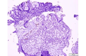 Image of Azer Scientific Control SLIDE, Helicobacter ESCS-130