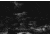 Shinenyx AIM101 384 5.2x48mm Thermal Imaging Rifle Scope, Black, AIM101