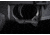 Strike Industries PolyFlex Trigger Guard With Finger Rest, AR-10/ AR-15, Black, SI-POLYFLEX-TG