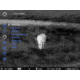 Pulsar Thermion 2 LRF XG50 Thermal Riflescope, 3-24x, 640x480 Sensor Resolution, 50hz, Multiple Reticle, Black PL76554